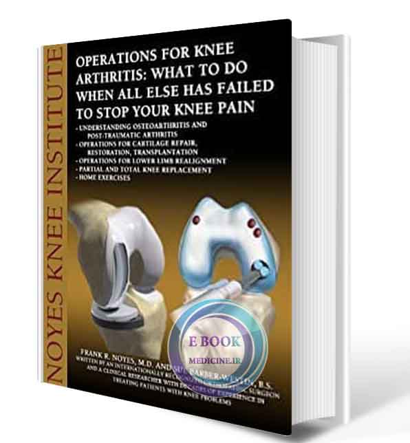 دانلود کتاب Operations for Knee Arthritis: What To Do When All Else Has Failed To Stop Your Knee Pain  (ORIGINAL PDF)